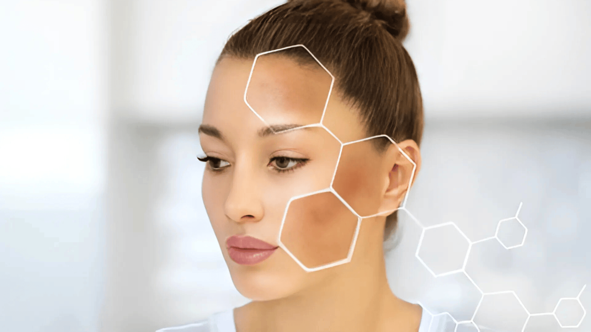 remove-dark-spots-from-face